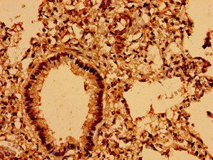 ASPM Antibody