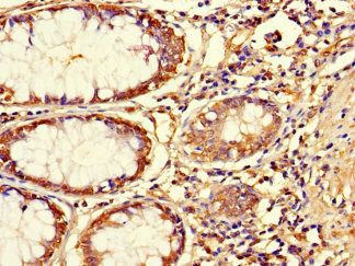 ASPN Antibody