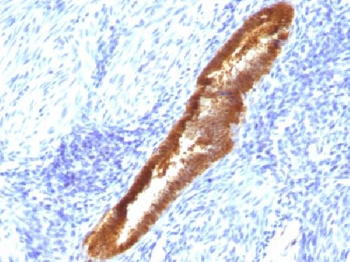 ASRGL1 (Asparaginase Like 1) Antibody