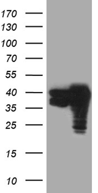 ASS1 Antibody