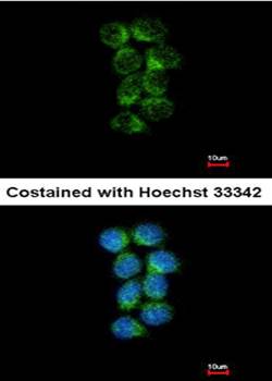 ASS1 antibody