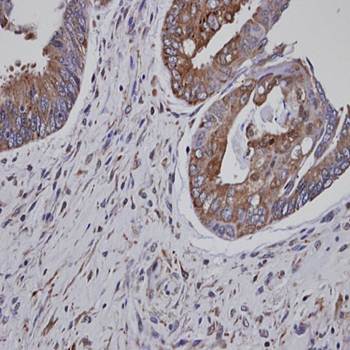 ASS1 antibody