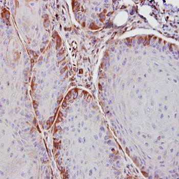 ASS1 antibody