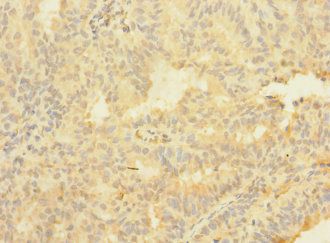 ASTL Antibody