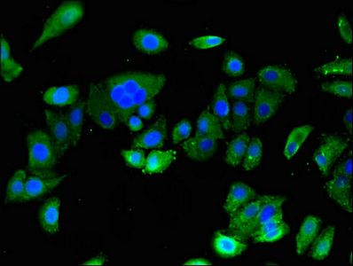 ASTN2 antibody