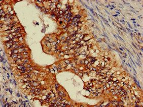 ASTN2 Antibody