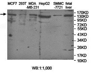 ASTN2 Rabbit Polyclonal Antibody
