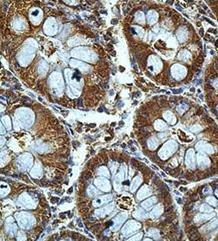 ASTN2 Rabbit Polyclonal Antibody