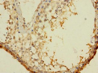 ASZ1 Antibody