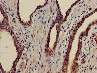 ATAD1 Antibody