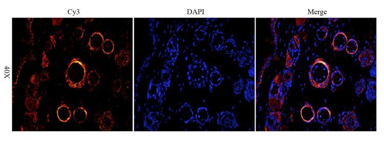 ATAD2 Antibody