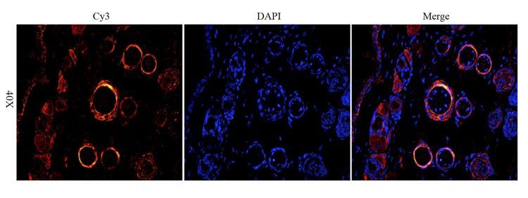 ATAD2 Antibody