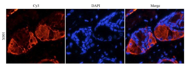 ATAD2 Antibody