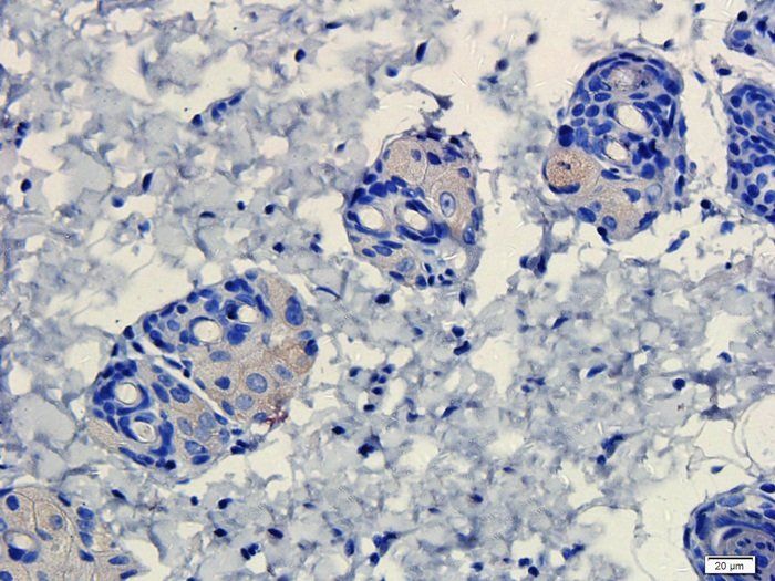 ATAD2 Antibody