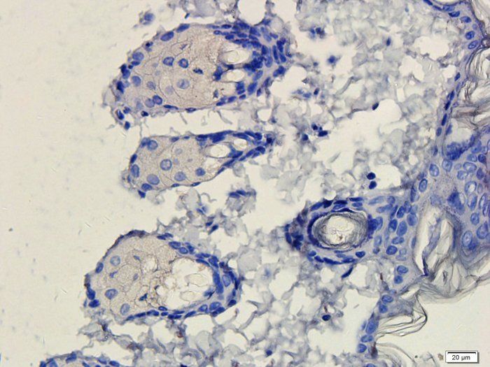 ATAD2 Antibody