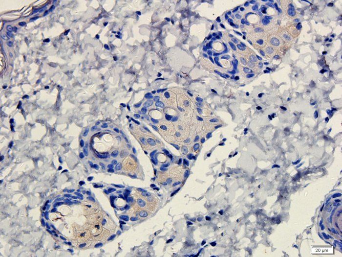 ATAD2 Antibody