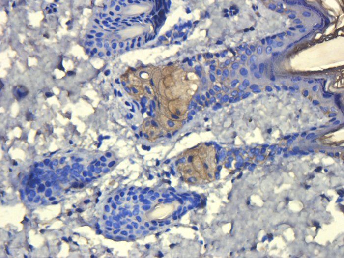 ATAD2 Antibody