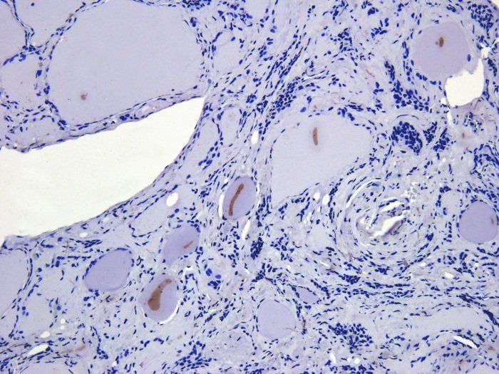 ATAD2 Antibody