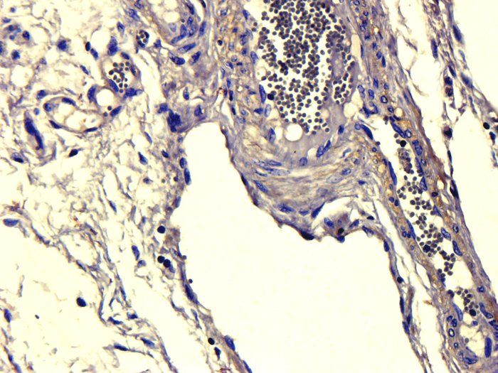 ATAD2 Antibody