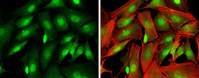Ataxin 3 antibody