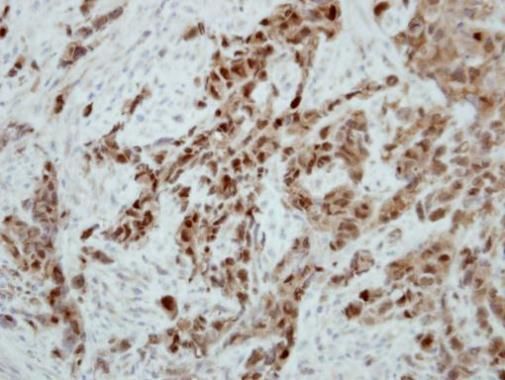 Ataxin 3 antibody