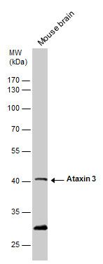 ataxin 3 Antibody