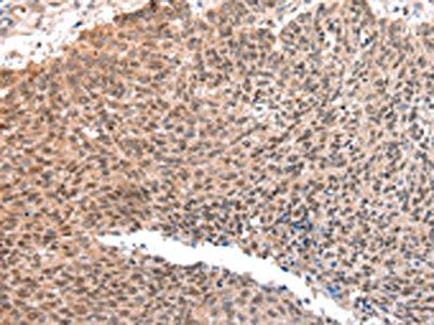 ATF1 Antibody