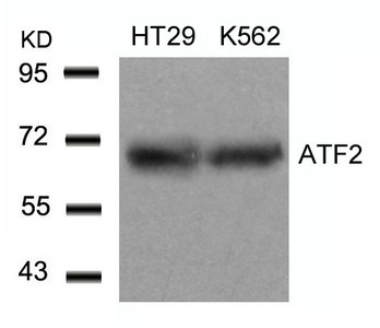 ATF2 (Ab-71 or 53) antibody