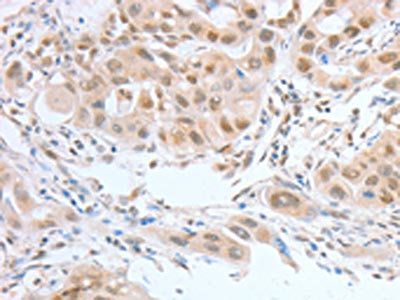 ATF2 Antibody