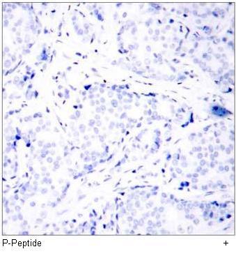 ATF2 (Phospho-Ser112 or 94) Antibody