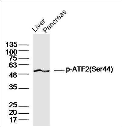ATF2 (phospho-Ser44) antibody