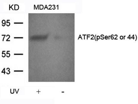 ATF2 (Phospho-Ser62 or 44) Antibody