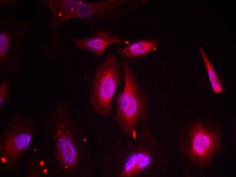 ATF2 (Phospho-Thr69 or 51) Antibody