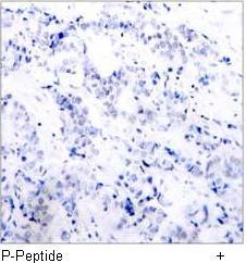 ATF2 (Phospho-Thr71 or 53) Antibody