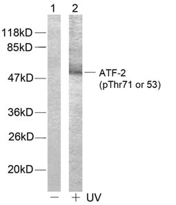 ATF2 (Phospho-Thr71 or 53) Antibody