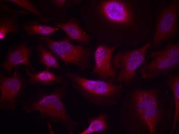 ATF2 (Phospho-Thr73 or 55) Antibody