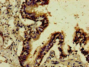 ATF3 Antibody