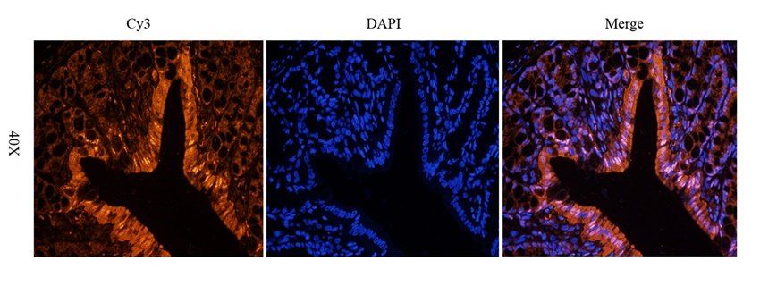 ATF4 antibody