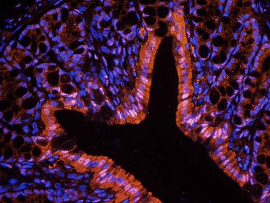 ATF4 antibody