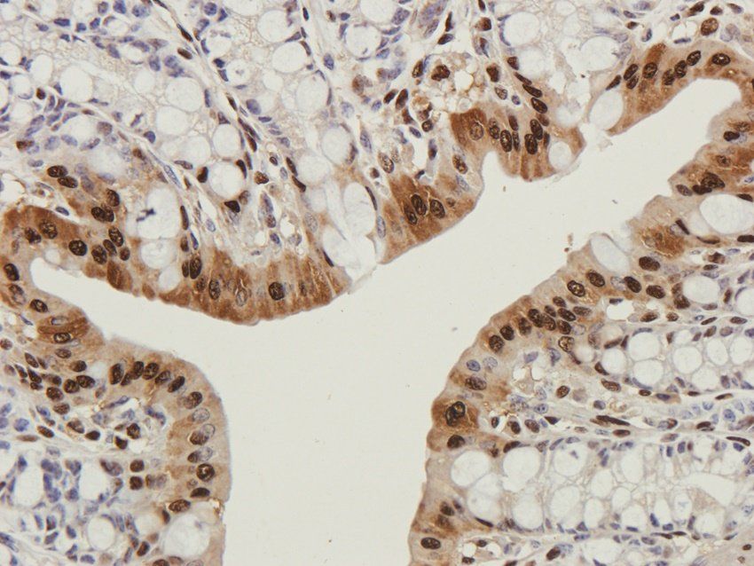 ATF4 antibody