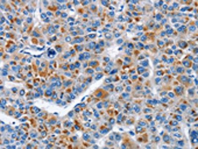 ATF4 Antibody