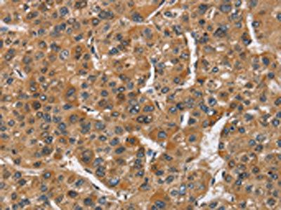 ATF4 Antibody