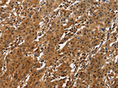 ATF4 Antibody