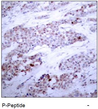ATF4 (Phospho-Ser245) Antibody