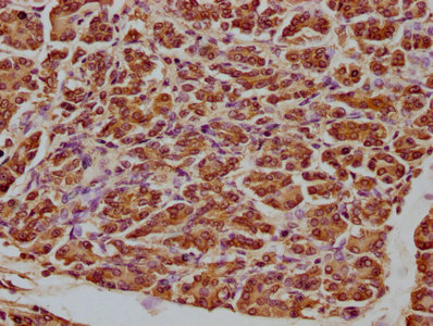ATF5 Antibody