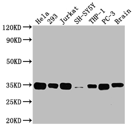 ATF5 Recombinant Monoclonal Antibody