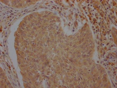ATF6 Antibody