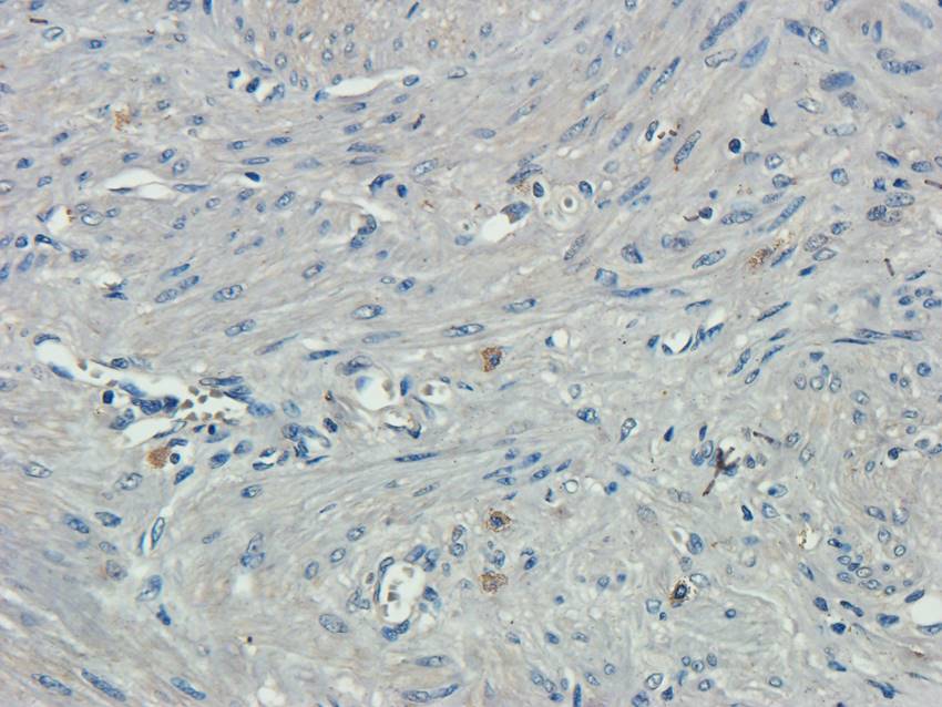 ATF6 antibody