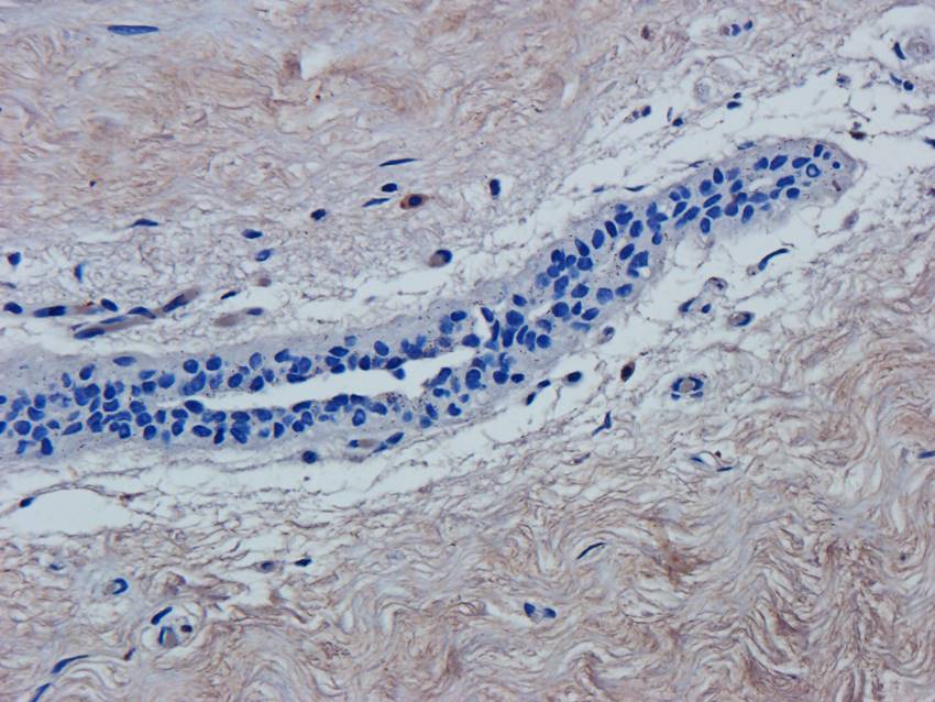 ATF6 antibody