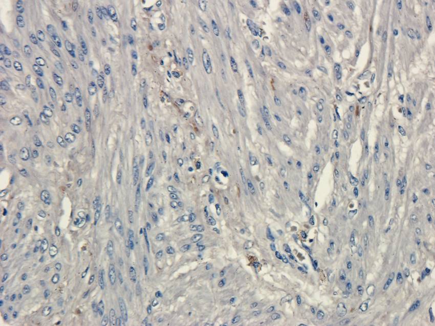 ATF6 antibody